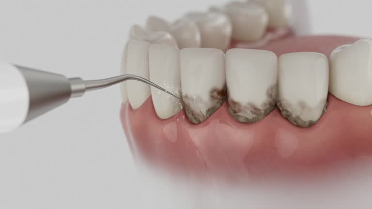 Reliable Dental Implants contractor in Park Hills, MO by Smile Center Dentistry